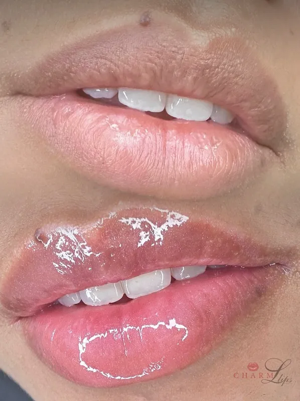 Lábios após o Hidragloss, hidratados e com aspecto mais volumoso
